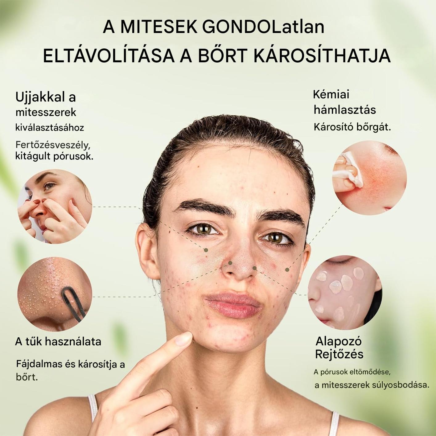 LANBENA Fekete Mitesszer Eltávolító Orrtapaszok (60 db)